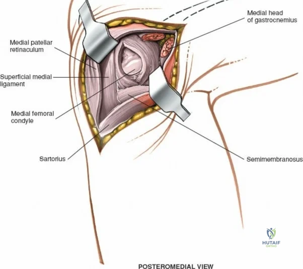 Clinical Image