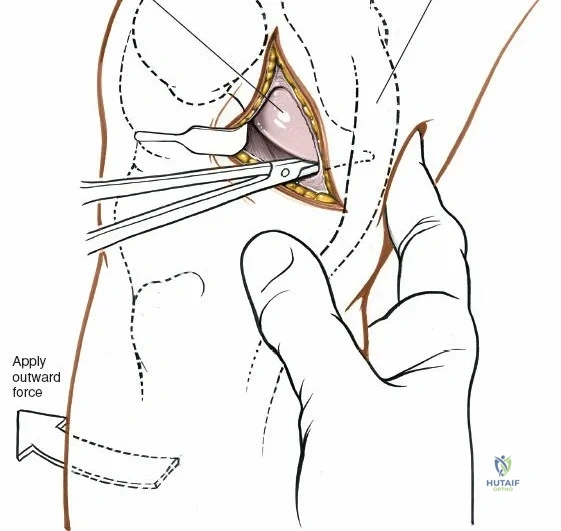 Clinical Image