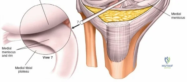 Clinical Image