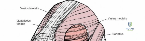 Clinical Image