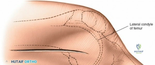 Clinical Image