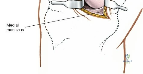 Clinical Image