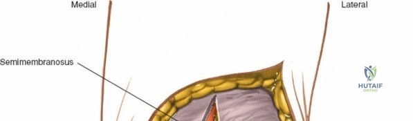 Clinical Image
