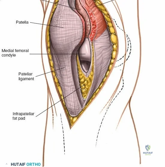 Clinical Image