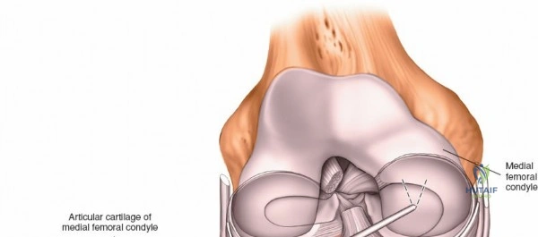 Clinical Image