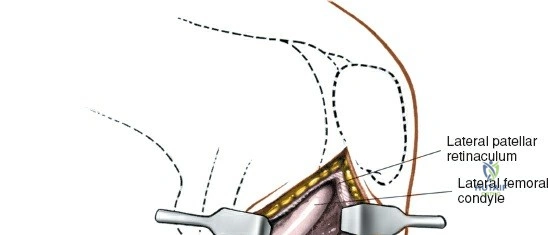 Clinical Image