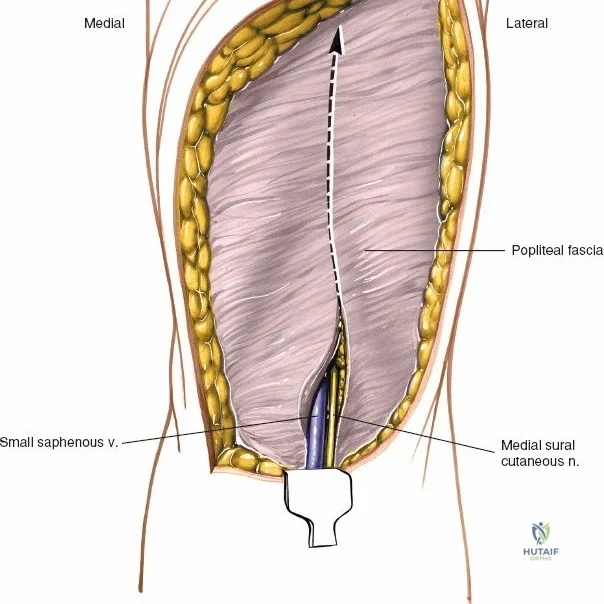 Clinical Image