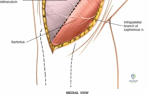 Clinical Image