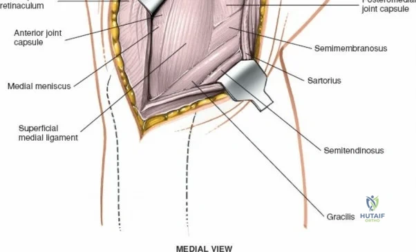 Clinical Image