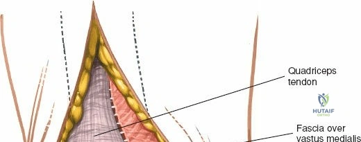Clinical Image