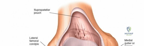 Clinical Image