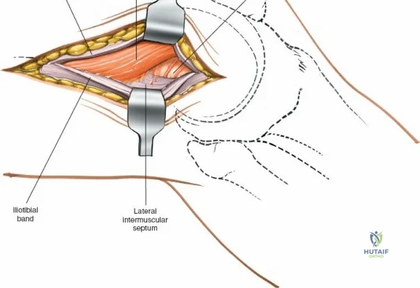 Clinical Image