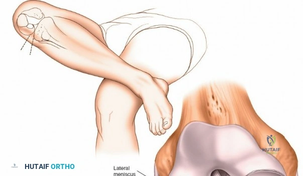 Clinical Image