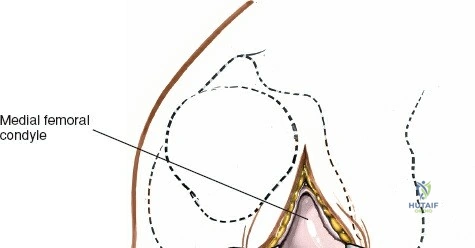 Clinical Image