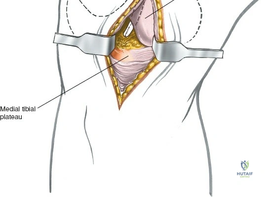 Clinical Image