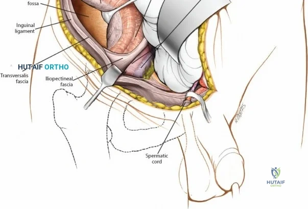 Clinical Image