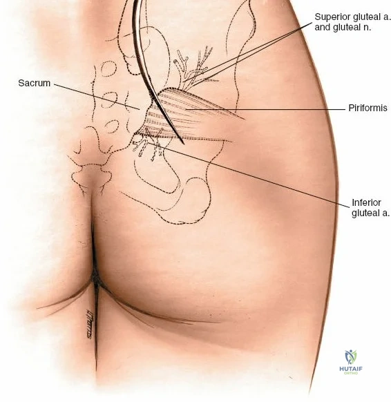 Clinical Image