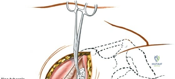 Clinical Image