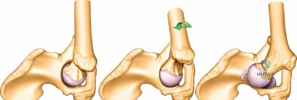 Clinical Image
