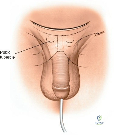 Clinical Image