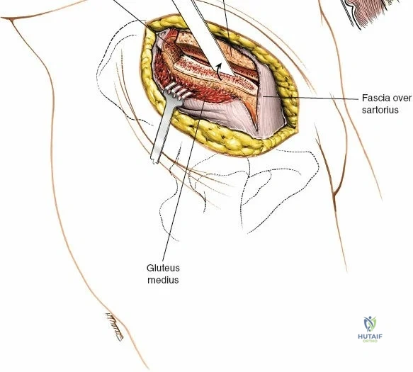 Clinical Image