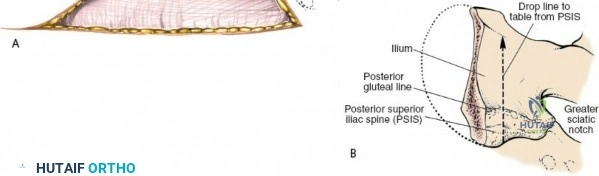 Clinical Image