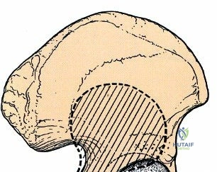 Clinical Image