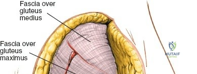Clinical Image