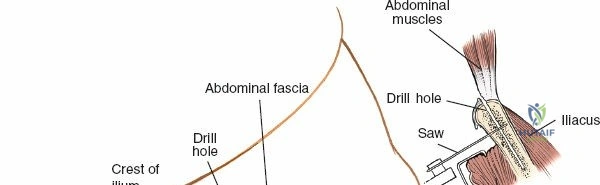 Clinical Image