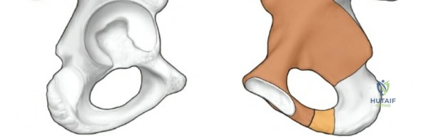Clinical Image