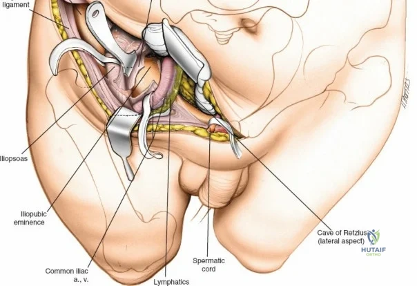 Clinical Image