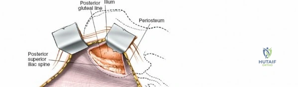 Clinical Image