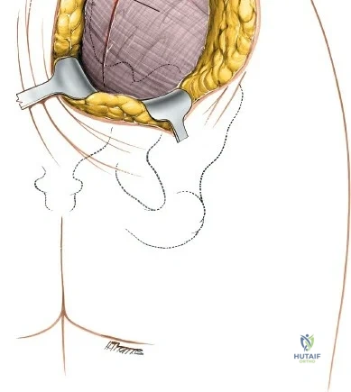 Clinical Image