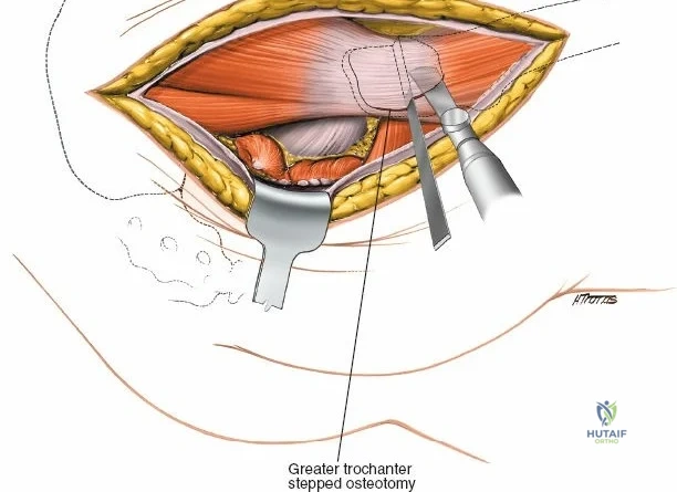 Clinical Image
