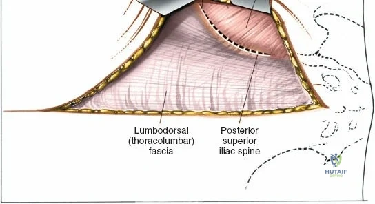 Clinical Image