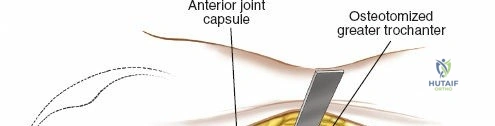 Clinical Image
