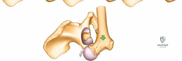 Clinical Image
