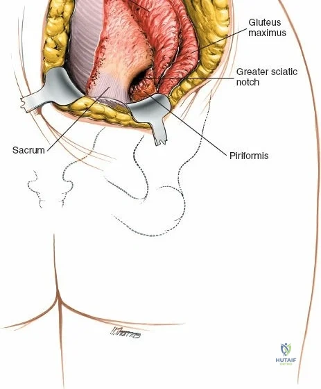 Clinical Image