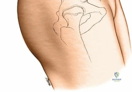 Clinical Image