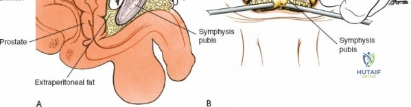 Clinical Image