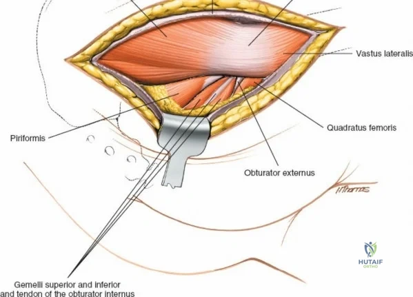 Clinical Image