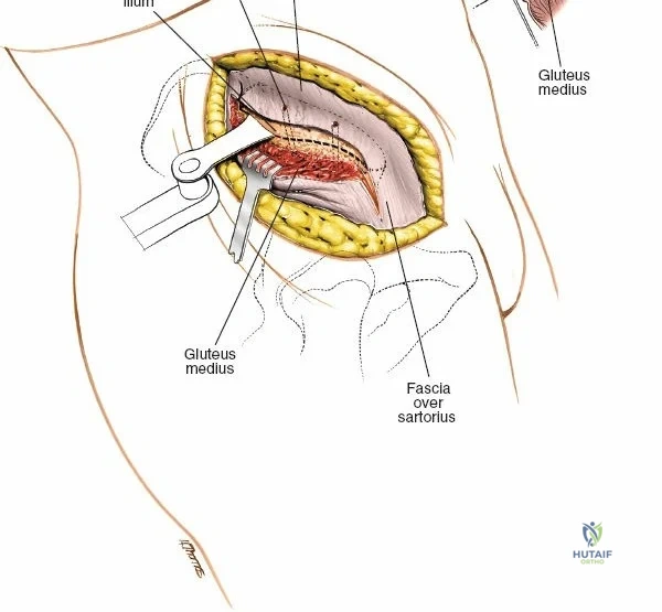 Clinical Image