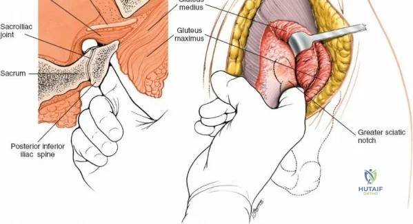 Clinical Image