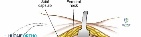 Clinical Image