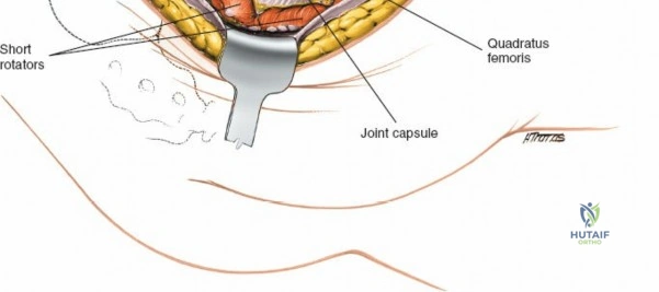 Clinical Image