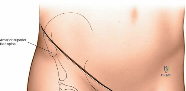 Clinical Image