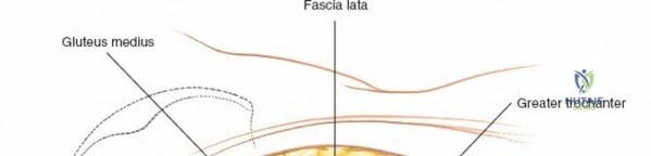 Clinical Image