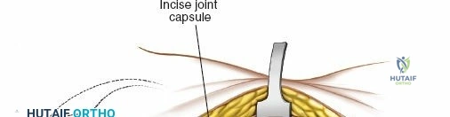 Clinical Image