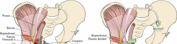 Clinical Image