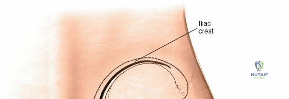 Clinical Image